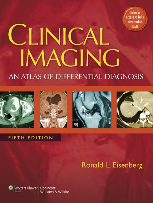 Clinical Imaging: An Atlas of Differential Diagnosis (Clinical Imaging: An Atlas of Differential Diagnosis (Eisenberg)) - 6240