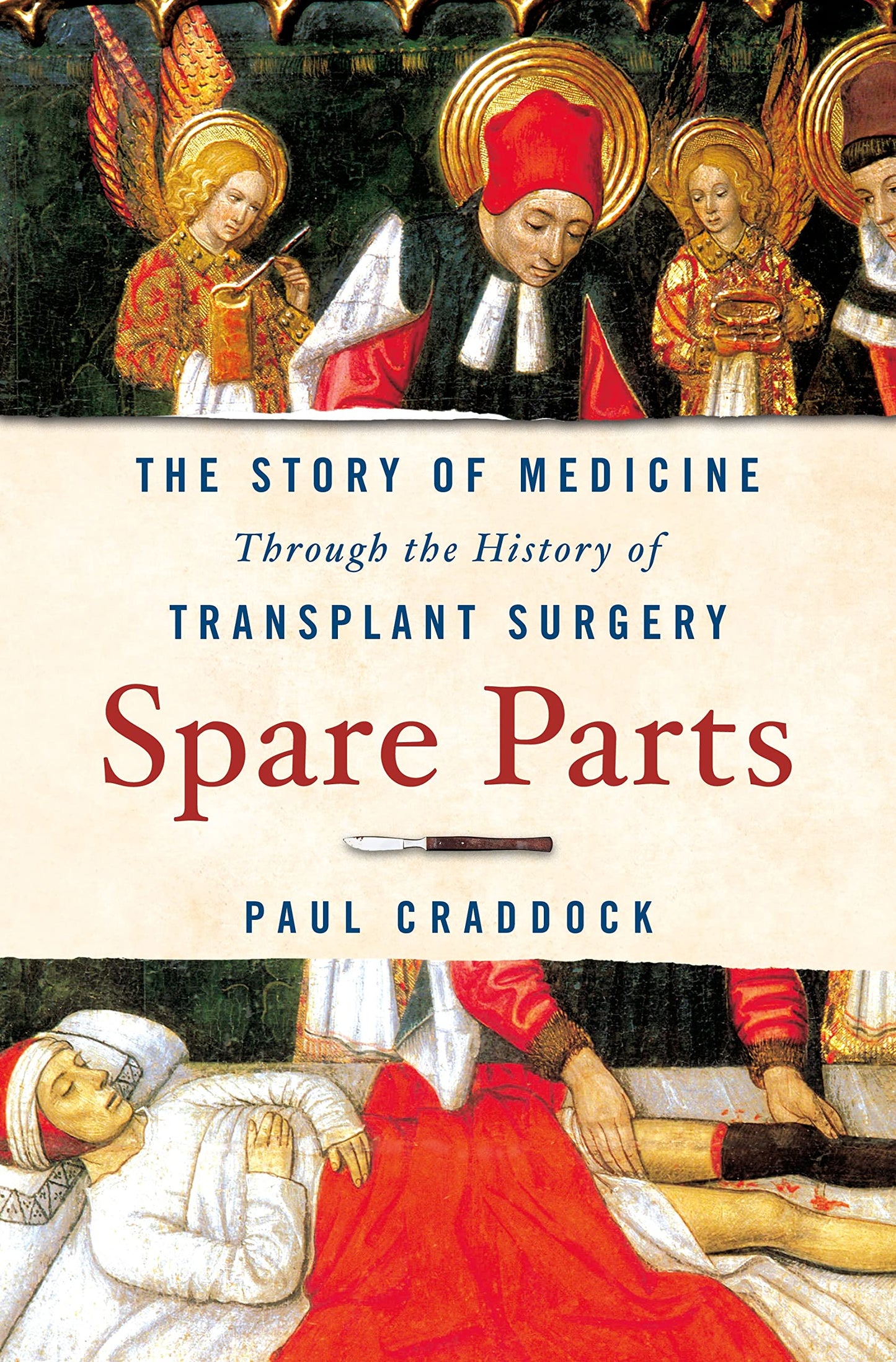 Spare Parts: The Story of Medicine Through the History of Transplant Surgery The Happy Book Stack