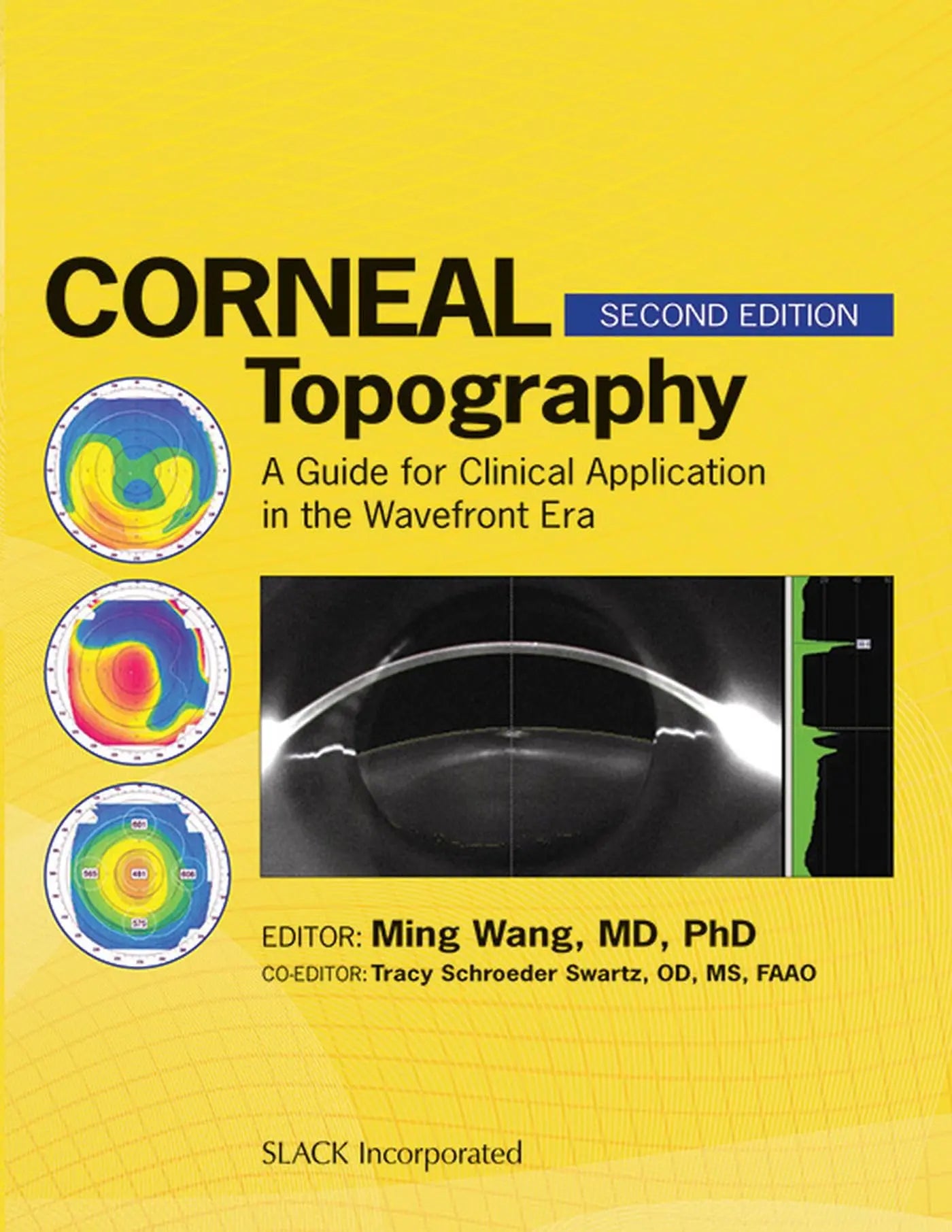 Corneal Topography: A Guide for Clinical Application in Wavefront Era The Happy Book Stack