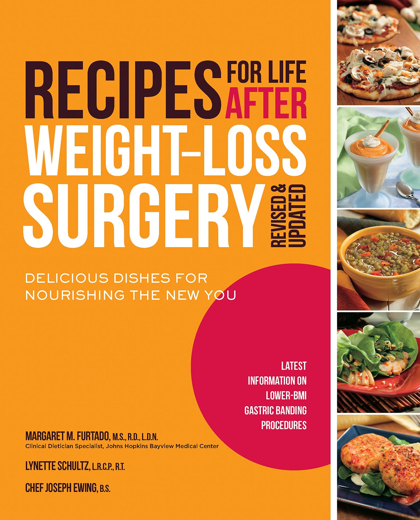Recipes for Life After Weight-Loss Surgery, Revised and Updated: Delicious Dishes for Nourishing the New You and the Latest Information on Lower-BMI Gastric Banding Procedures The Happy Book Stack