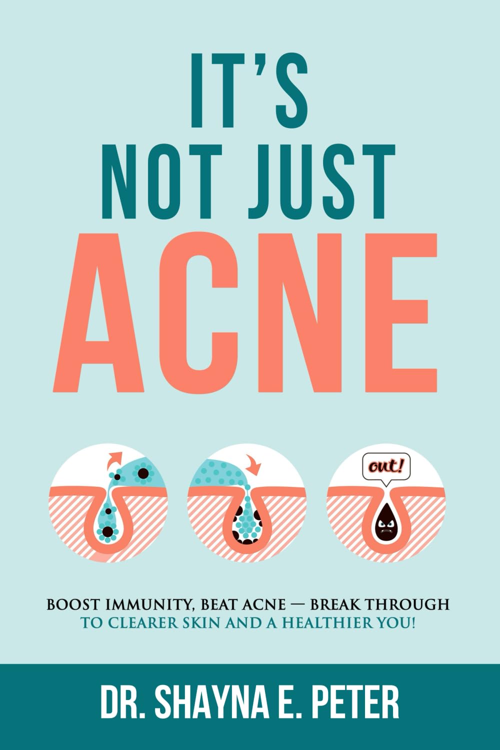 It's Not Just Acne: Boost Immunity, Beat Acne - Break Through to Clearer Skin & A Healthier You! The Happy Book Stack