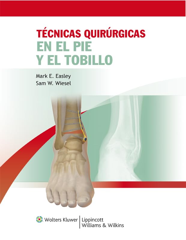 Tcnicas quirrgicas en pie y tobillo (Spanish Edition) The Happy Book Stack