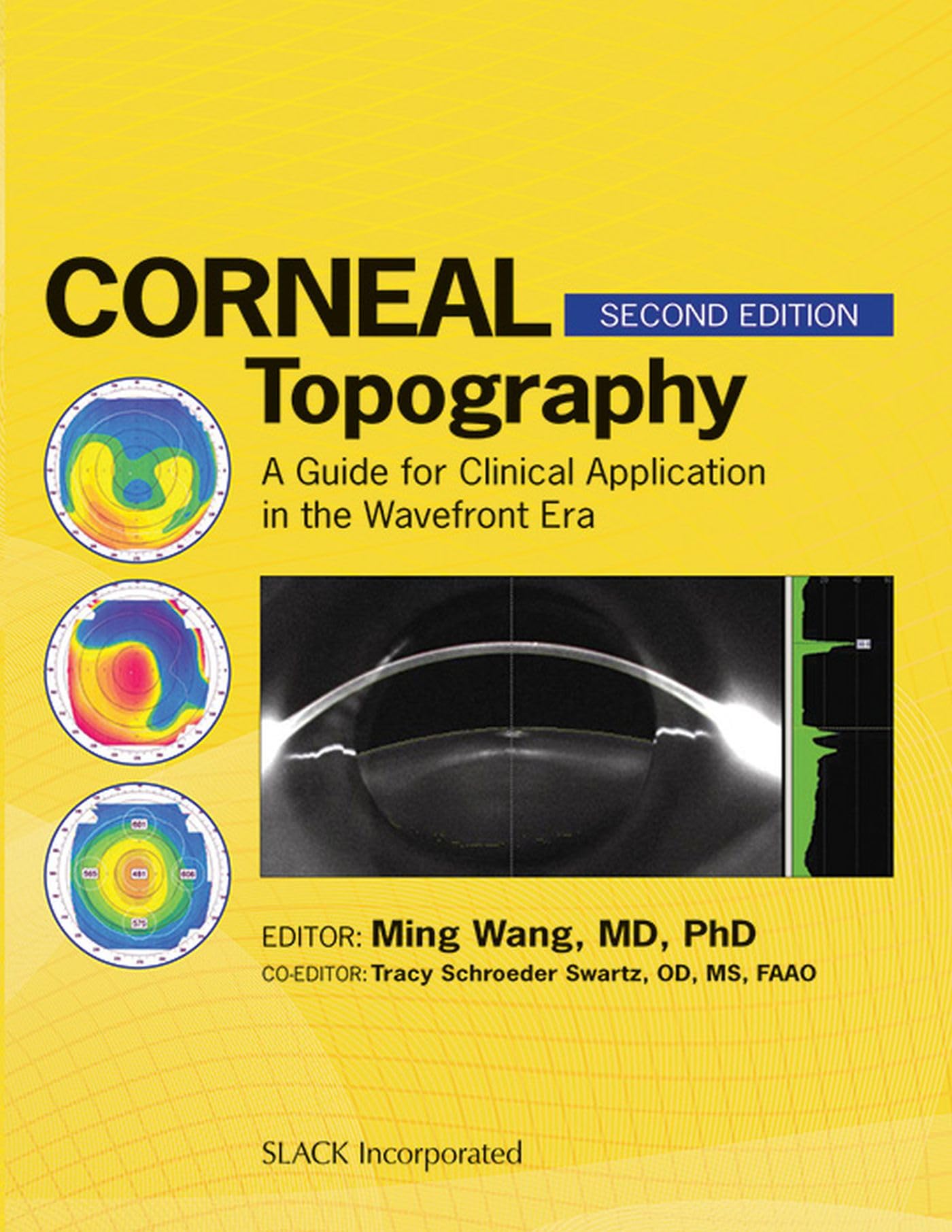 Corneal Topography: A Guide for Clinical Application in Wavefront Era - 7027